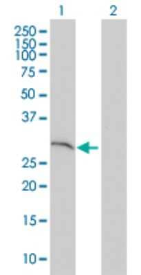 Western Blot: SNAP29 Antibody (3E4-E6) [H00009342-M01]