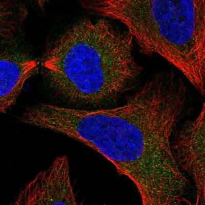 Immunocytochemistry/ Immunofluorescence: SNAP29 Antibody [NBP2-58573]