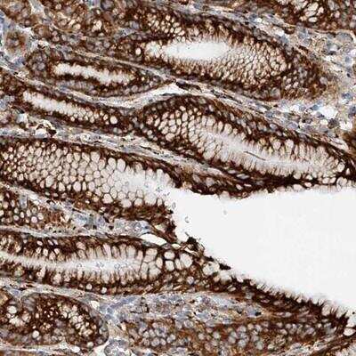 Immunohistochemistry-Paraffin: SNAP29 Antibody [NBP1-84552]