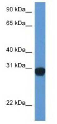 Western Blot: SNAP29 Antibody [NBP1-79769]