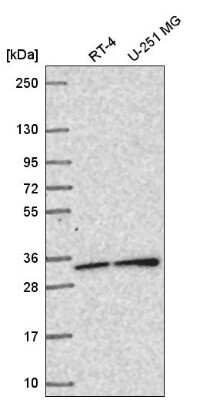 Western Blot: SNAP29 Antibody [NBP2-58573]