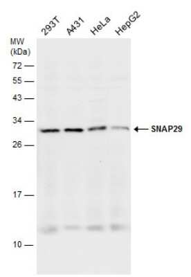 Western Blot: SNAP29 Antibody [NBP3-12979]