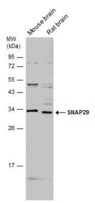 Western Blot: SNAP29 Antibody [NBP3-12979]