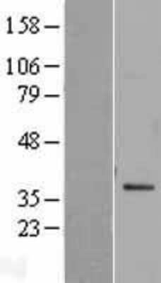 Western Blot: SNAP29 Overexpression Lysate [NBP2-04278]