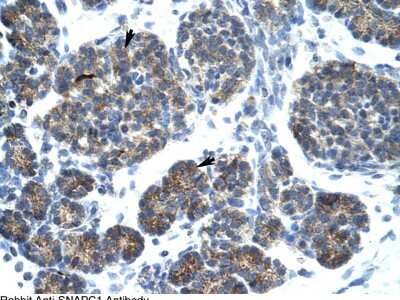 Immunohistochemistry: SNAP43 Antibody [NBP2-88319]