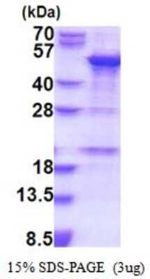 SDS-PAGE: Recombinant Human SNAP43 His Protein [NBP2-51829]