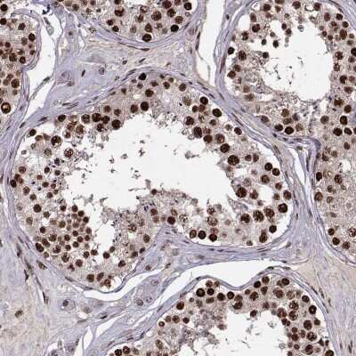 Immunohistochemistry: SNAP45 Antibody [NBP2-69047]