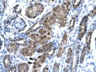 Immunohistochemistry: SNAP45 Antibody [NBP3-10291]