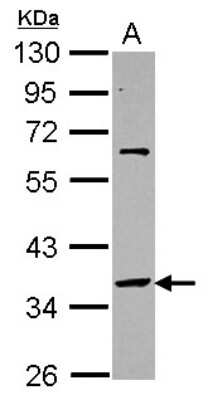 Western Blot: SNAP45 Antibody [NBP2-15124]