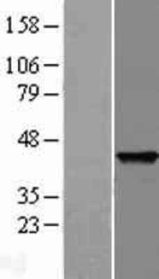 Western Blot: SNAP45 Overexpression Lysate [NBP2-10866]