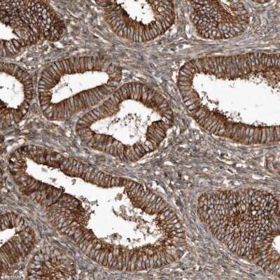 Immunohistochemistry-Paraffin: SNAP47 Antibody [NBP1-88483]
