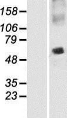 Western Blot: SNAP47 Overexpression Lysate [NBP2-05822]