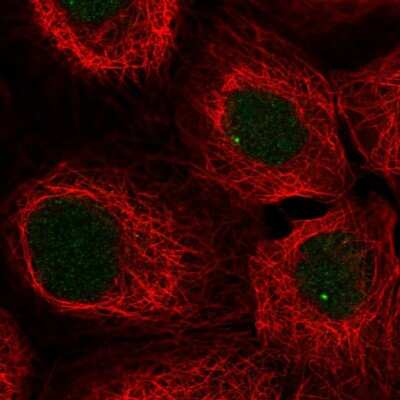 Immunocytochemistry/ Immunofluorescence: SNAPC3 Antibody [NBP2-58320]