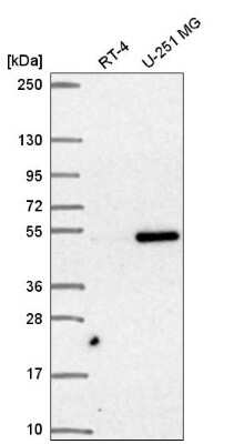 Western Blot: SNAPC3 Antibody [NBP2-57713]