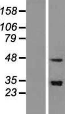 Western Blot: SNAPC3 Overexpression Lysate [NBL1-16272]