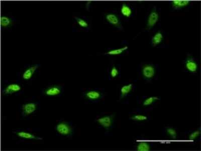 Immunocytochemistry/ Immunofluorescence: SNAPC4 Antibody (1D1) [H00006621-M01]