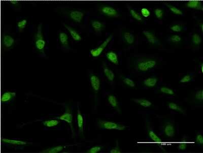 Immunocytochemistry/ Immunofluorescence: SNAPC4 Antibody (3F10) [H00006621-M07]