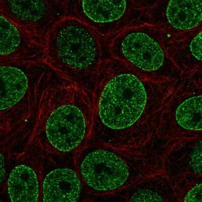 Immunocytochemistry/ Immunofluorescence: SNAPC4 Antibody [NBP2-57849]