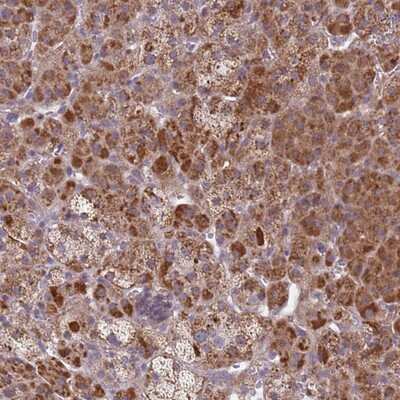 Immunohistochemistry-Paraffin: SNAPC4 Antibody [NBP1-92413]