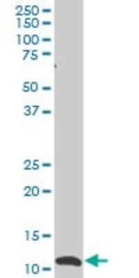 Western Blot: SNAPC5 Antibody (5C3) [H00010302-M02]