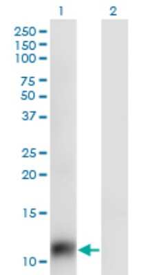 Western Blot: SNAPC5 Antibody (5C3) [H00010302-M02]