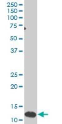 Western Blot: SNAPC5 Antibody (5E2) [H00010302-M03]