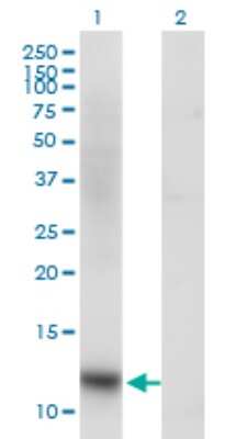 Western Blot: SNAPC5 Antibody (5E2) [H00010302-M03]