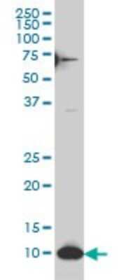 Western Blot: SNAPC5 Antibody (6G10) [H00010302-M07]