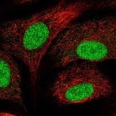 Immunocytochemistry/ Immunofluorescence: SNAPC5 Antibody [NBP2-47267]