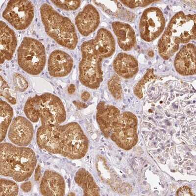 Immunohistochemistry: SNAPC5 Antibody [NBP2-47267]