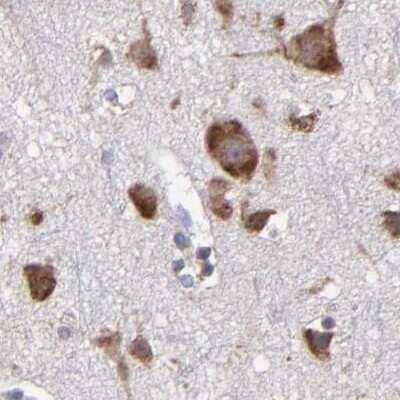 Immunohistochemistry-Paraffin: SND1 Antibody [NBP1-82460]