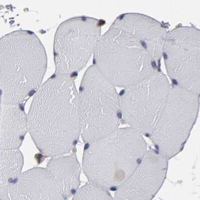 Immunohistochemistry-Paraffin: SND1 Antibody [NBP1-82460]