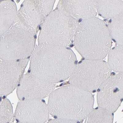 Immunohistochemistry-Paraffin: SND1 Antibody [NBP1-82461]