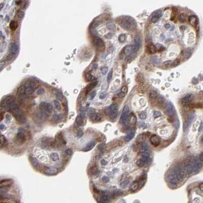 Immunohistochemistry-Paraffin: SND1 Antibody [NBP1-82461]