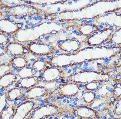 Immunohistochemistry-Paraffin: SND1 Antibody - Azide and BSA Free [NBP2-94469]