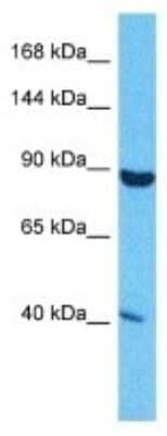 Western Blot: SND1 Antibody [NBP3-09955]