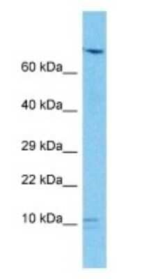 Western Blot: SND1-IT1 Antibody [NBP3-09331]