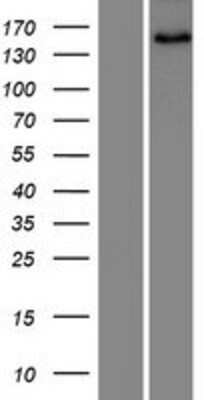 Western Blot: SNED1 Overexpression Lysate [NBP2-08496]