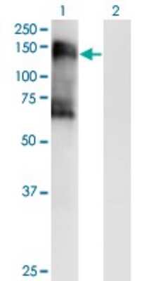 Western Blot: SNF1LK2/SIK2 Antibody (4C6) [H00023235-M03]