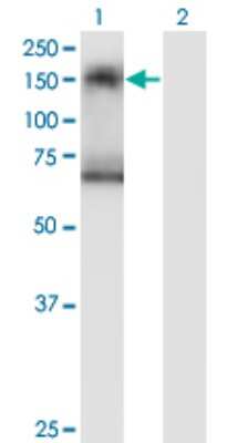 Western Blot: SNF1LK2/SIK2 Antibody (4H6) [H00023235-M01]