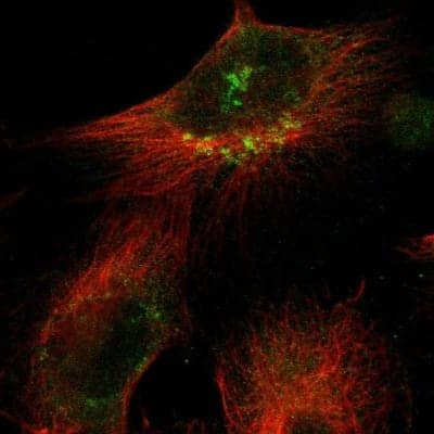 Immunocytochemistry/ Immunofluorescence: SNF1LK2/SIK2 Antibody [NBP1-85114]