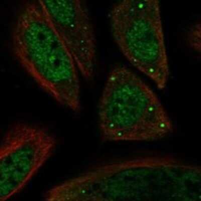 Immunocytochemistry/ Immunofluorescence: SNF1LK2/SIK2 Antibody [NBP3-17676]