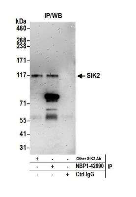 Immunoprecipitation: SNF1LK2/SIK2 Antibody [NBP1-42690]