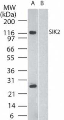 Western Blot: SNF1LK2/SIK2 Antibody [NB100-56458]