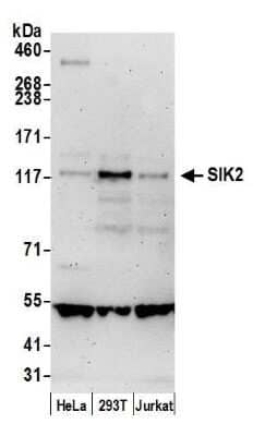 Western Blot: SNF1LK2/SIK2 Antibody [NBP1-42690]