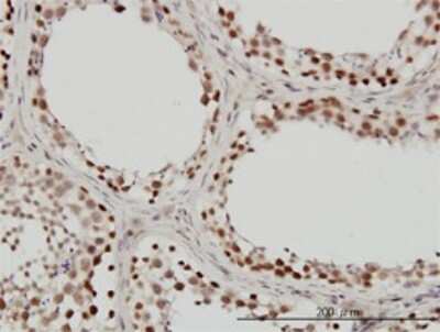 Immunohistochemistry-Paraffin: SNF5 Antibody (3E10) [H00006598-M01]