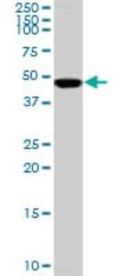 Western Blot: SNF5 Antibody (3E10) [H00006598-M01]