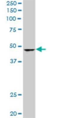 Western Blot: SNF5 Antibody (3E10) [H00006598-M01]