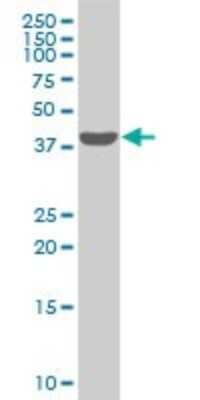 Western Blot: SNF5 Antibody (3E3) [H00006598-M02]
