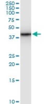 Western Blot: SNF5 Antibody (3E3) [H00006598-M02]